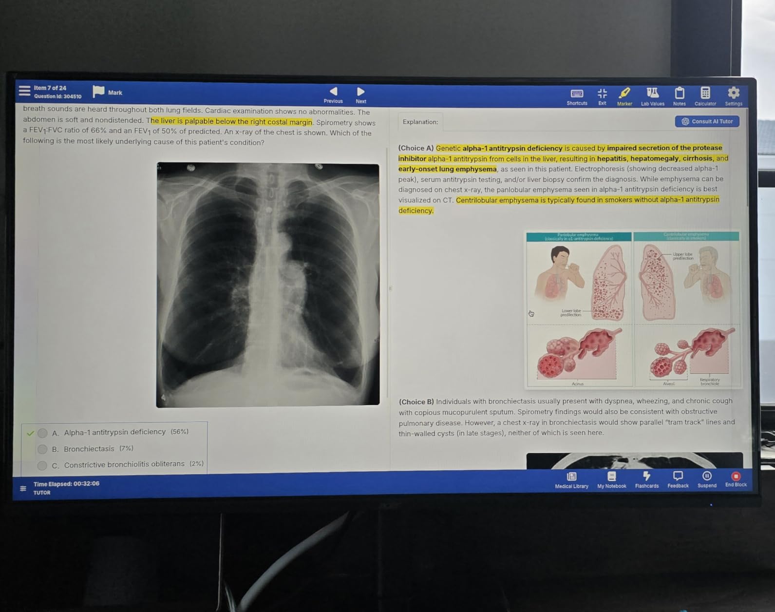 Acer 27in FHD 1920x1080 IPS 120Hz Gaming Monitor | Office KB272 G0bi customer photo 2